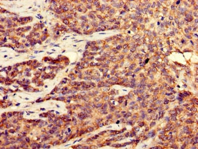 CDK5 Antibody (aa1-292)