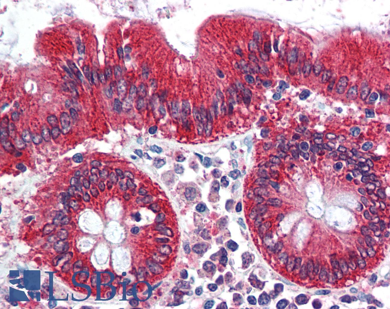 IHC-plus™ NEUROG3 / NGN3 / Neurogenin 3 Antibody (N-Terminus)