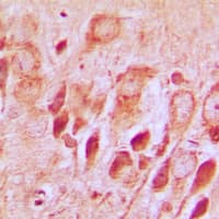 SNCAIP / Synphilin 1 Antibody (C-Terminus)
