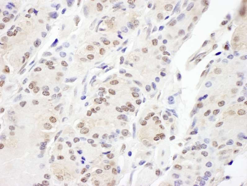 AAAS / Adracalin Antibody (aa496-546)