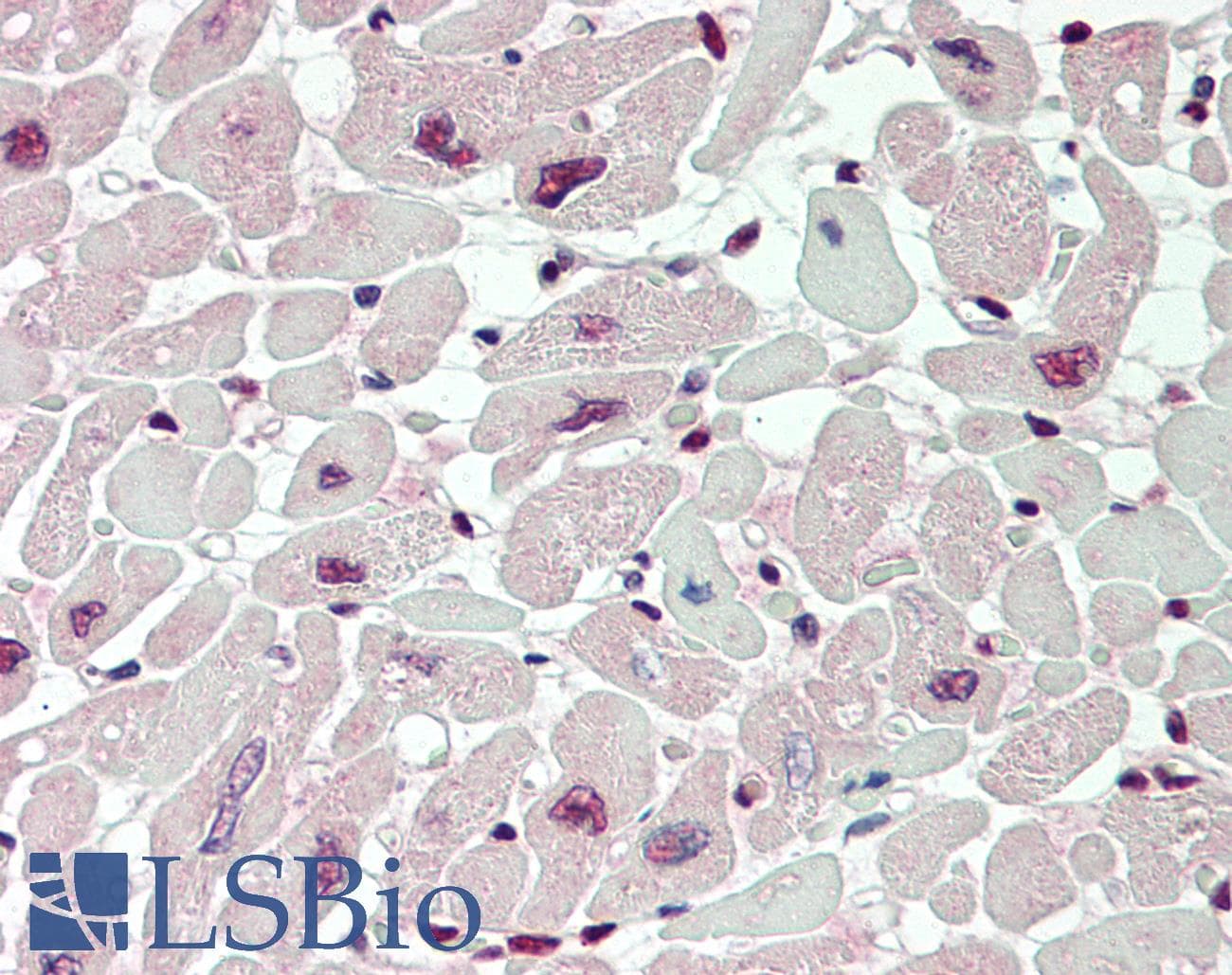 IHC-plus™ Monoclonal Mouse anti-Human VWA5A Antibody (clone 3A3, IHC, IF, WB)