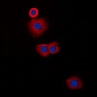 CLIP3 Antibody (Internal)