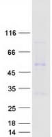 Human ITM2C Protein (Recombinant Myc-DDK (Flag))