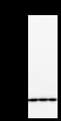 PSMC5 / SUG1 Antibody (clone 2837C4a)