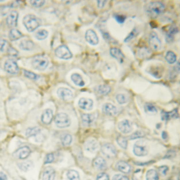 HSPB6 / HSP20 Antibody (phospho-Ser16)