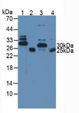 TNNI3 / Cardiac Troponin I Antibody (aa1-203)