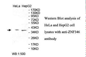 Polyclonal Rabbit anti-Human ZNF346 Antibody (aa95-289, IHC, WB)