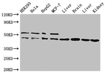 IDH1 / IDH Antibody