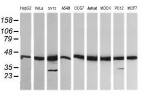 Monoclonal Mouse anti-Human MAP2K1 / MKK1 / MEK1 Antibody (clone OTI1A9, IHC, IF, WB)