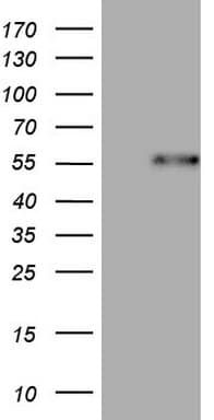 DUSP10 / MKP5 Antibody (aa180-482, clone OTI2H1)