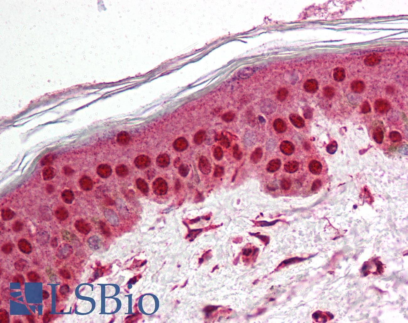 IHC-plus™ TP1 / TEP1 Antibody