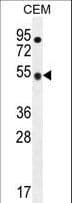 Polyclonal Rabbit anti-Human TBC1D13 Antibody (aa76-105, IHC, IF, WB)
