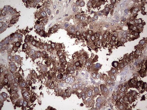 Monoclonal Mouse anti-Human PKM2 Antibody (clone 11B11, IHC, WB)