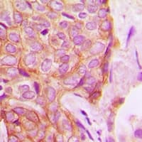 PRKCD / PKC-Delta Antibody (C-Terminus)