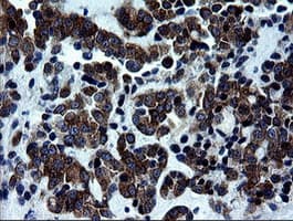 RTKN / Rhotekin Antibody (clone OTI1A4)