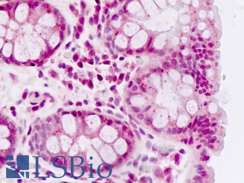 IHC-plus™ PDHX / Protein X / ProX Antibody (Thr11)