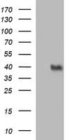 UPRT Antibody (clone OTI2D10)
