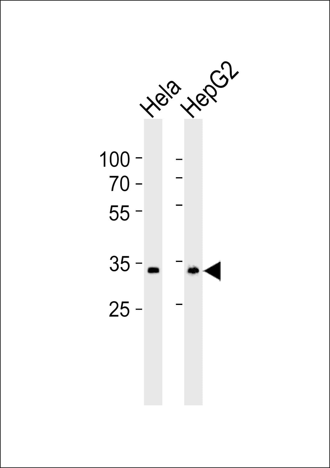 MT-ND1 Antibody (aa34-68)