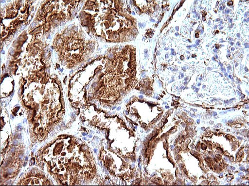 Monoclonal Mouse anti-Human SCAMP2 Antibody (clone OTI1H10, IHC, WB)