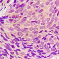 SYK Antibody (phospho-Tyr323)