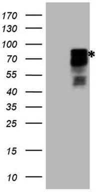 HIPK1 Antibody (aa439-697, clone OTI3C11)