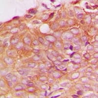SPTBN1 / ELF Antibody (Internal)