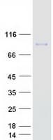 Human GNS Protein (Recombinant Myc-DDK (Flag))