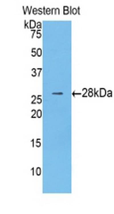 PathPlus™ CTNNB1 / Beta Catenin Antibody