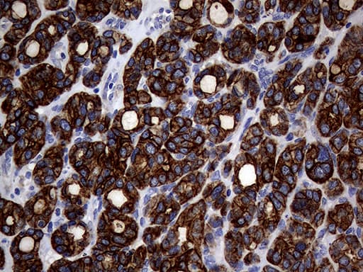 Monoclonal Mouse anti-Human KRT18 / CK18 / Cytokeratin 18 Antibody (clone OTI10H8, Carrier-free, aa69-372, IHC, WB)