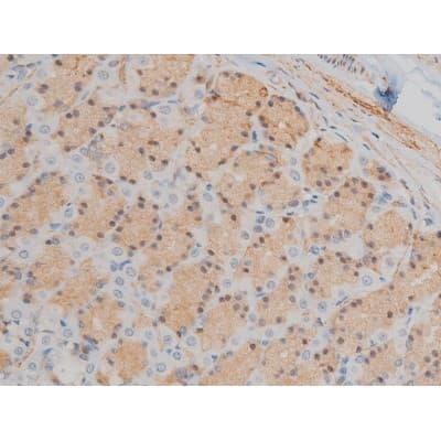 Polyclonal Rabbit anti-Human GFAP Antibody (phospho-Ser38, IHC, IF, WB)