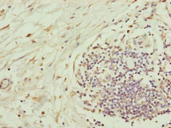 Polyclonal Rabbit anti-Human Complement C8b Antibody (aa55-350, IHC)