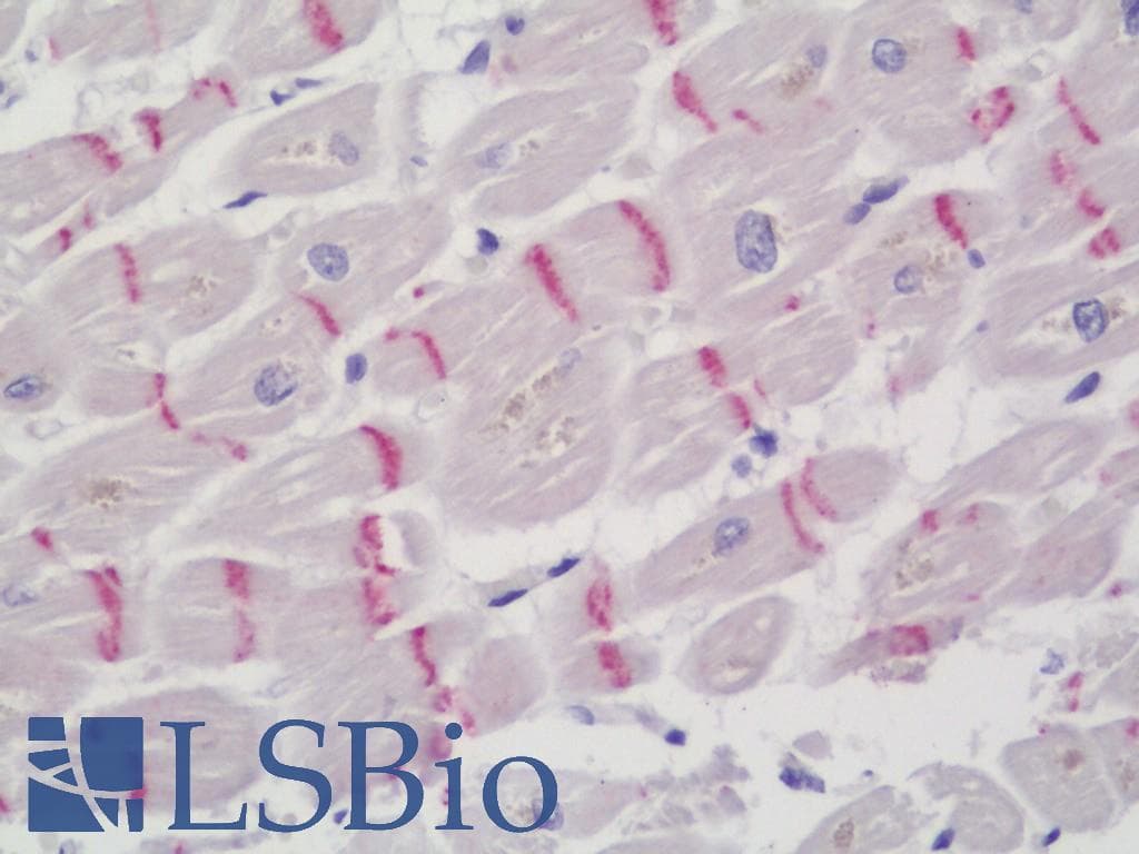 Polyclonal Rabbit anti-Human UCP2 Antibody (aa64-113, IHC)