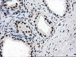 Monoclonal Mouse anti-Human PSMD10 / Gankyrin Antibody (clone OTI3F6, WB)