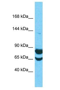 Polyclonal Rabbit anti-Human FAM91A1 Antibody (aa651-700, WB)