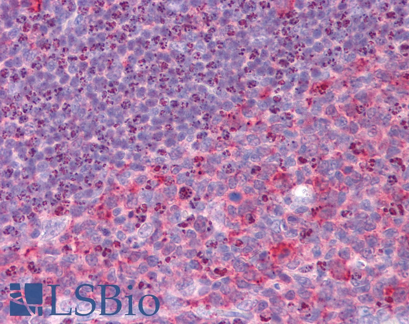 IHC-plus™ RHBDD3 Antibody