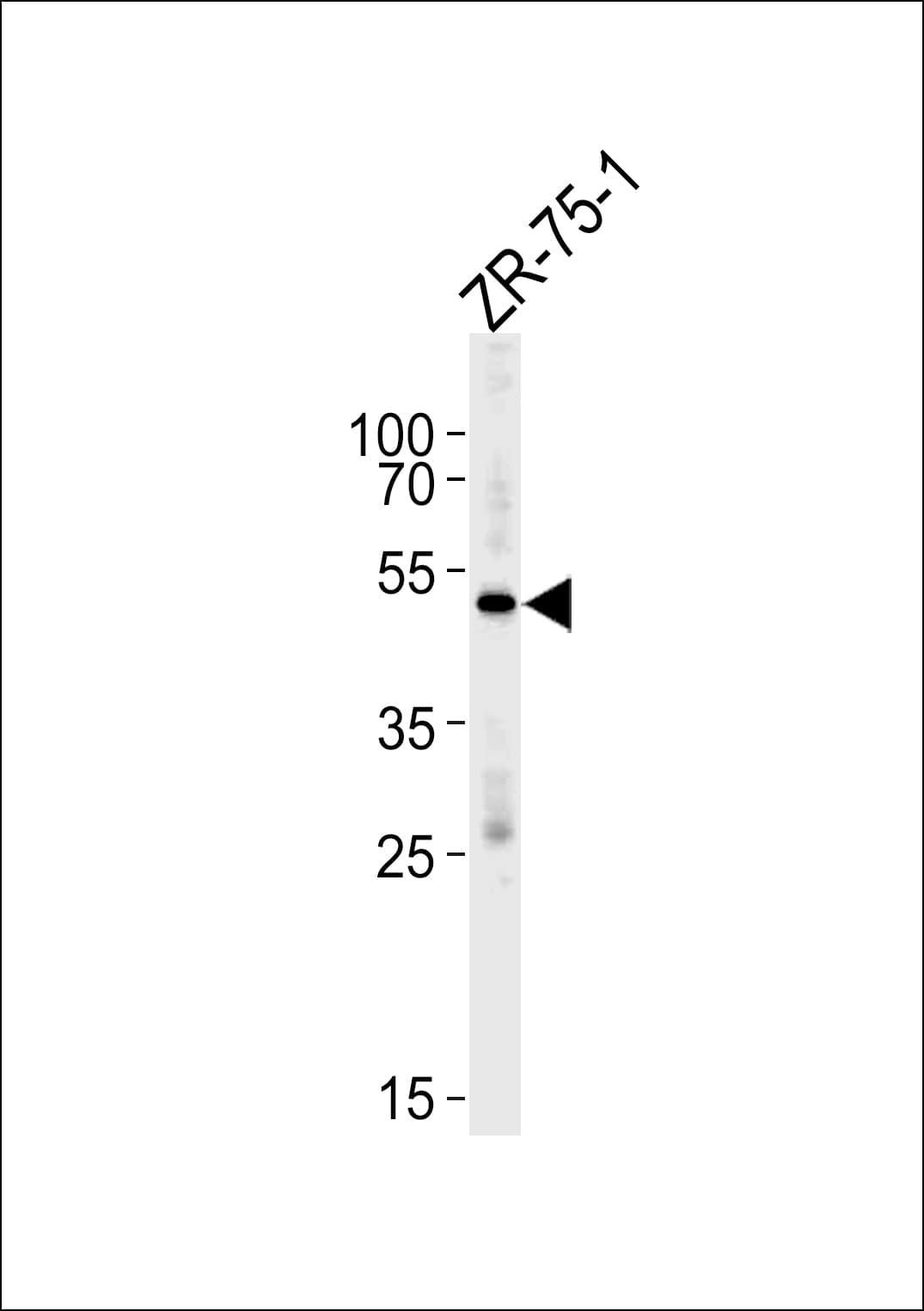 Polyclonal Rabbit anti-Human AGTR1 / AT1 Receptor Antibody (aa297-326, WB)