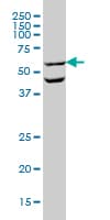 OCLN / Occludin Antibody (clone 1G7)