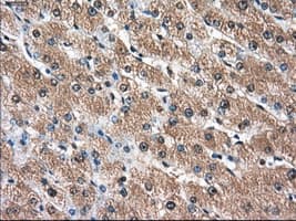 AKR1A1 Antibody (clone OTI2E7)