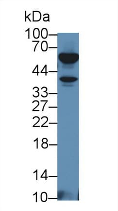 LTA / TNF Beta Antibody (aa49-202)