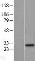 SLC25A52 Protein (Over-Expression Lysate Myc-DDK (Flag))