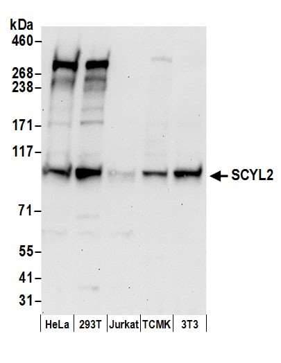 SCYL2 Antibody (aa825-875)