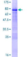 Human ZNF239 Protein (Recombinant GST)