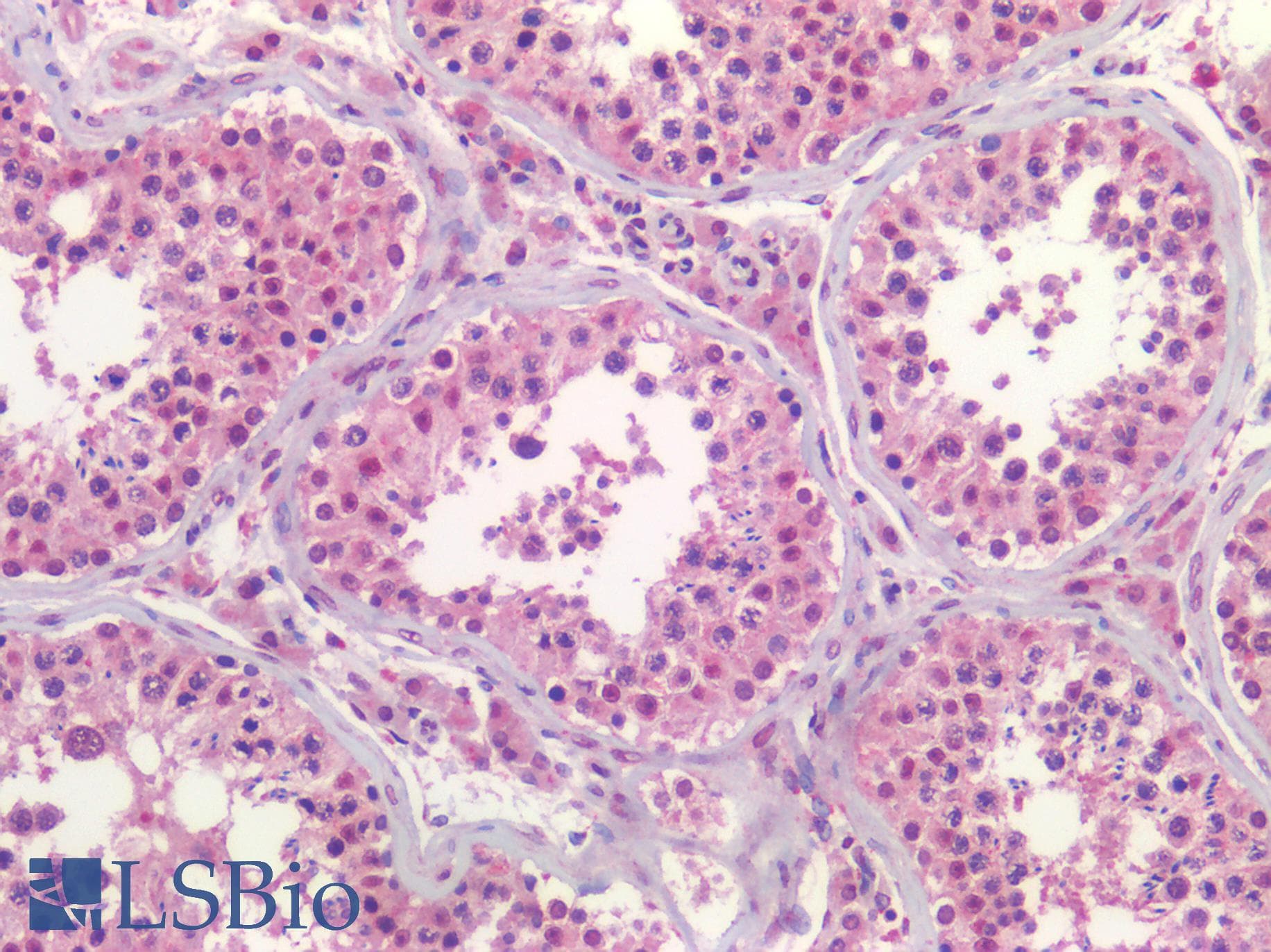 IHC-plus™ TIRC7 / TCIRG1 Antibody (C-Terminus)