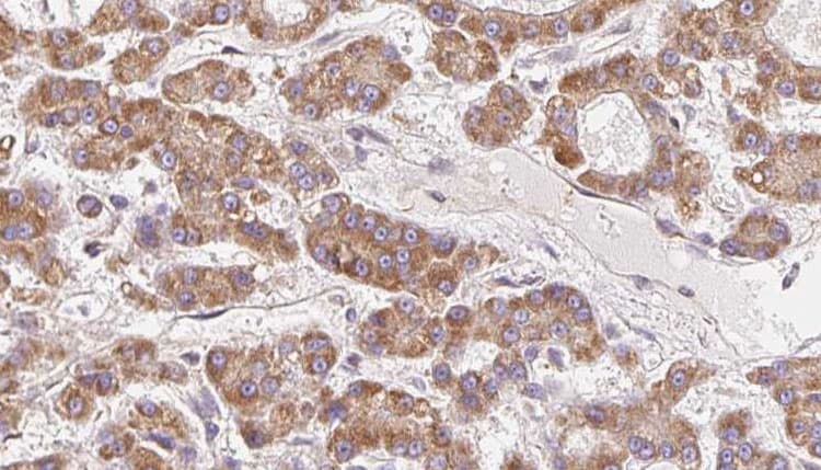 Polyclonal Rabbit anti-Human OR10H5 Antibody (IHC, WB)