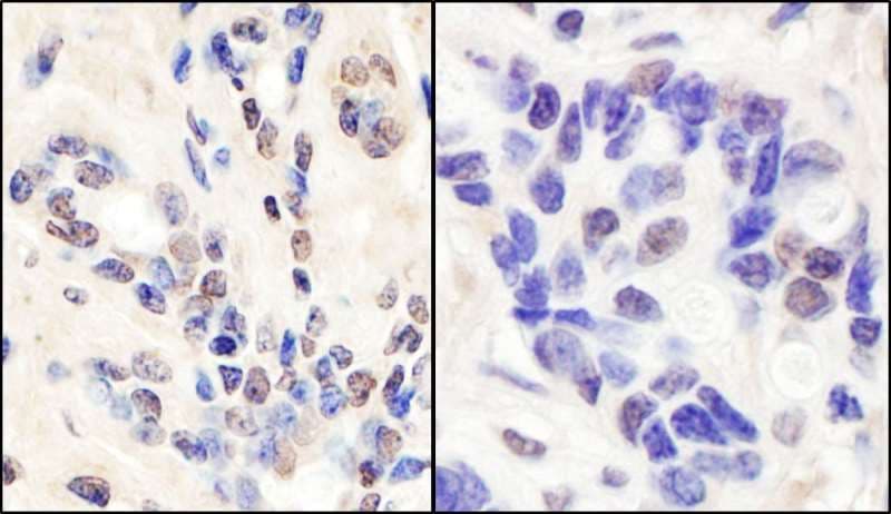 BRCA1 Antibody (aa250-300)