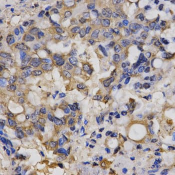 Polyclonal Rabbit anti-Human ClC-5 / CLCN5 Antibody (IHC, IF, WB)