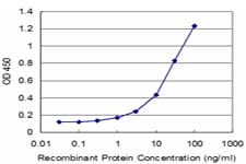 MYL6 Antibody (clone 1D6)