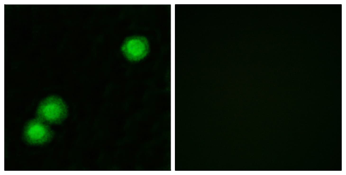 PKIB Antibody (aa29-78)