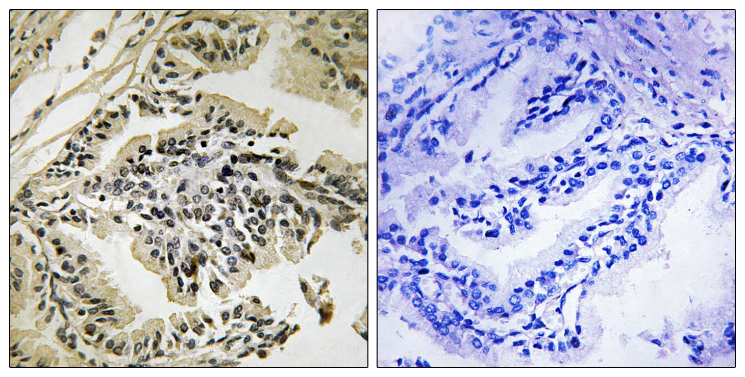 EIF2AK3 / PERK Antibody (phospho-Thr981)