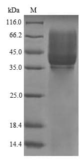 Pig CDH3 / P-Cadherin Protein (Recombinant 6His-SUMO, N-terminus)